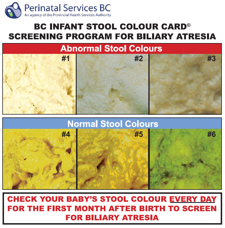 A portion of the stool colour card that is now being distributed to parents of newborns across B.C.