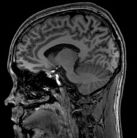 Brain scan_10a