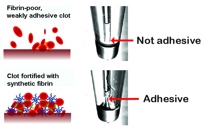 Left, top to bottom: Illustration of a blood clot lacking fibrin, and a clot fortified with synthetic fibrin. Right, top to bottom: Photo of normal plasma in a micropipette, and plasma fortified with synthetic fibrin.
