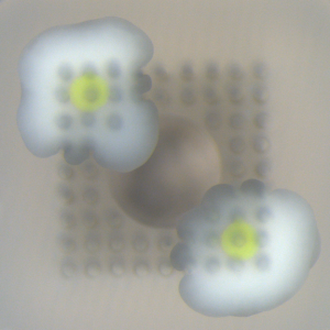 An overhead view of two organoids on a needle array, each with a glioma (in green) inside. Image courtesy of Cyfuse.