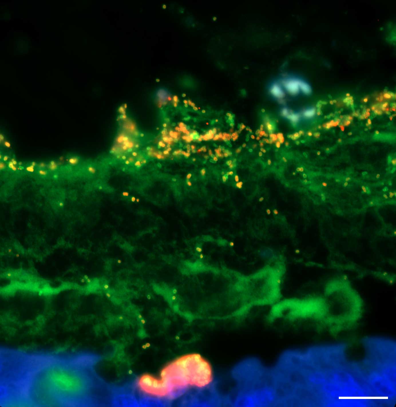 The Citrobacter rodentium (orange) rely on sugars in the intestinal mucus layer (green).